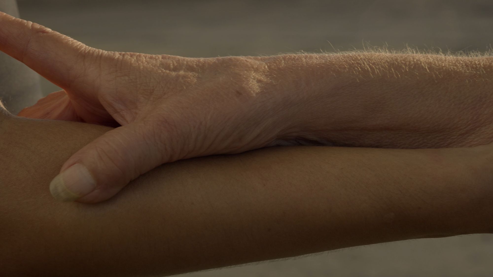 Primer plano de una mano abierta sobre un brazo; la piel a luz natural.
